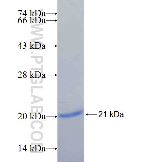 KCTD6 fusion protein Ag25631 SDS-PAGE KCTD6 fusion protein Ag25631 SDS-PAGE