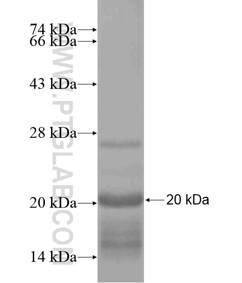 KCTD8 fusion protein Ag19799 SDS-PAGE KCTD8 fusion protein Ag19799 SDS-PAGE