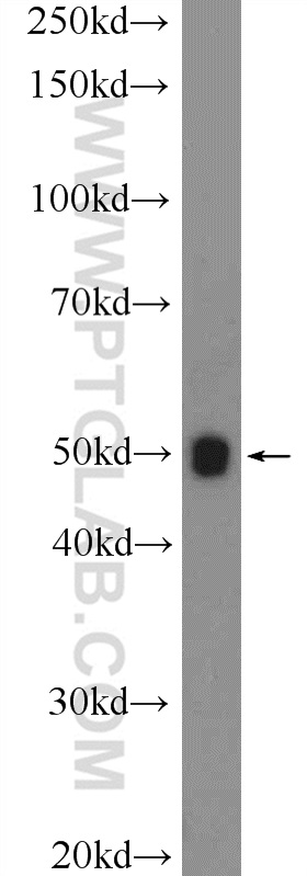 WB analysis of SMMC-7721 using 17018-1-AP
