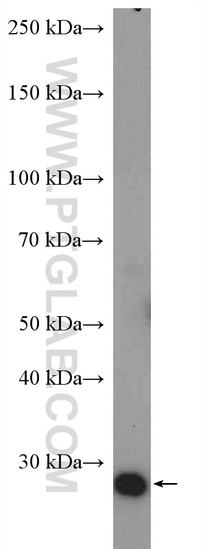 WB analysis of NIH/3T3 using 27632-1-AP