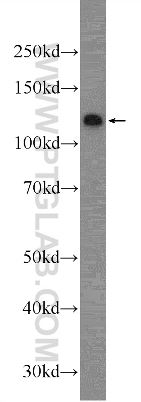 WB analysis of Jurkat using 24311-1-AP