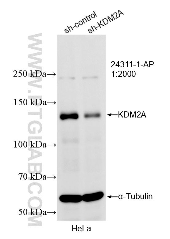 WB analysis of HeLa using 24311-1-AP
