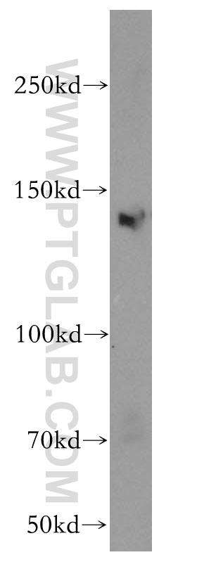 WB analysis of HeLa using 12835-1-AP