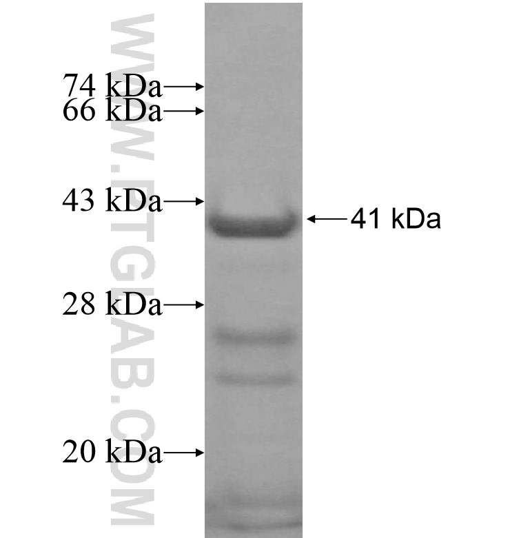KDM3B fusion protein Ag16809 SDS-PAGE KDM3B fusion protein Ag16809 SDS-PAGE