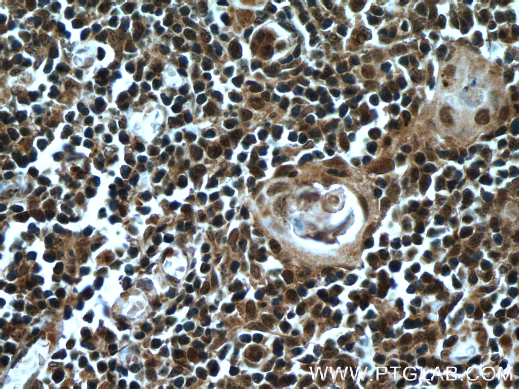 IHC staining of human thymus using 22591-1-AP