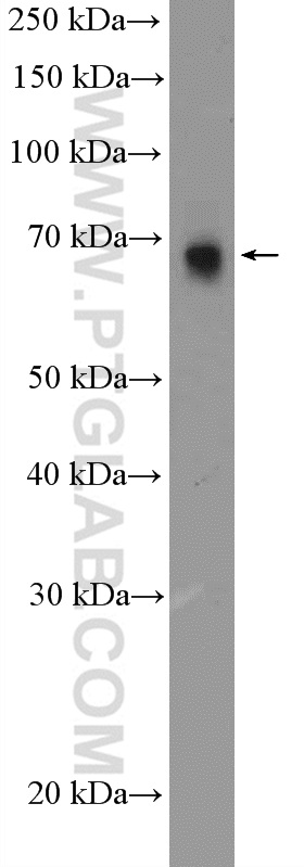 WB analysis of PC-3 using 22591-1-AP