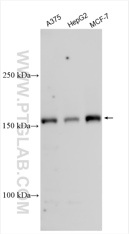 WB analysis using 28346-1-AP