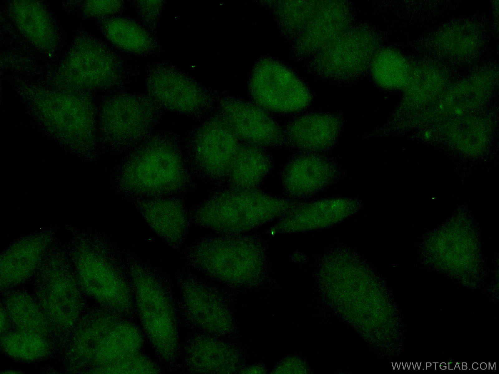 IF Staining of HeLa using 14426-1-AP