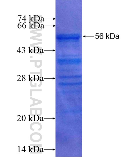 KDM5C fusion protein Ag15079 SDS-PAGE KDM5C fusion protein Ag15079 SDS-PAGE