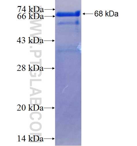 KDM5C fusion protein Ag5791 SDS-PAGE