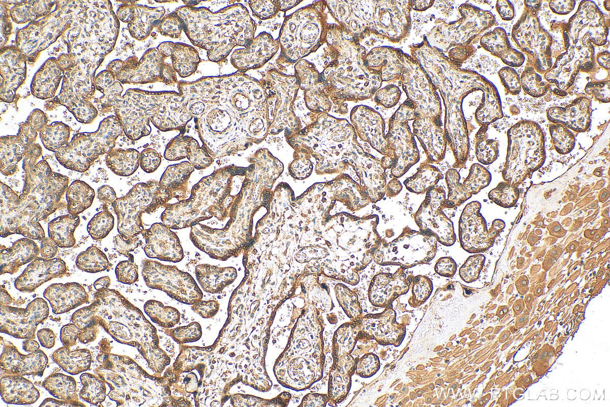 IHC staining of human placenta using 16228-1-AP