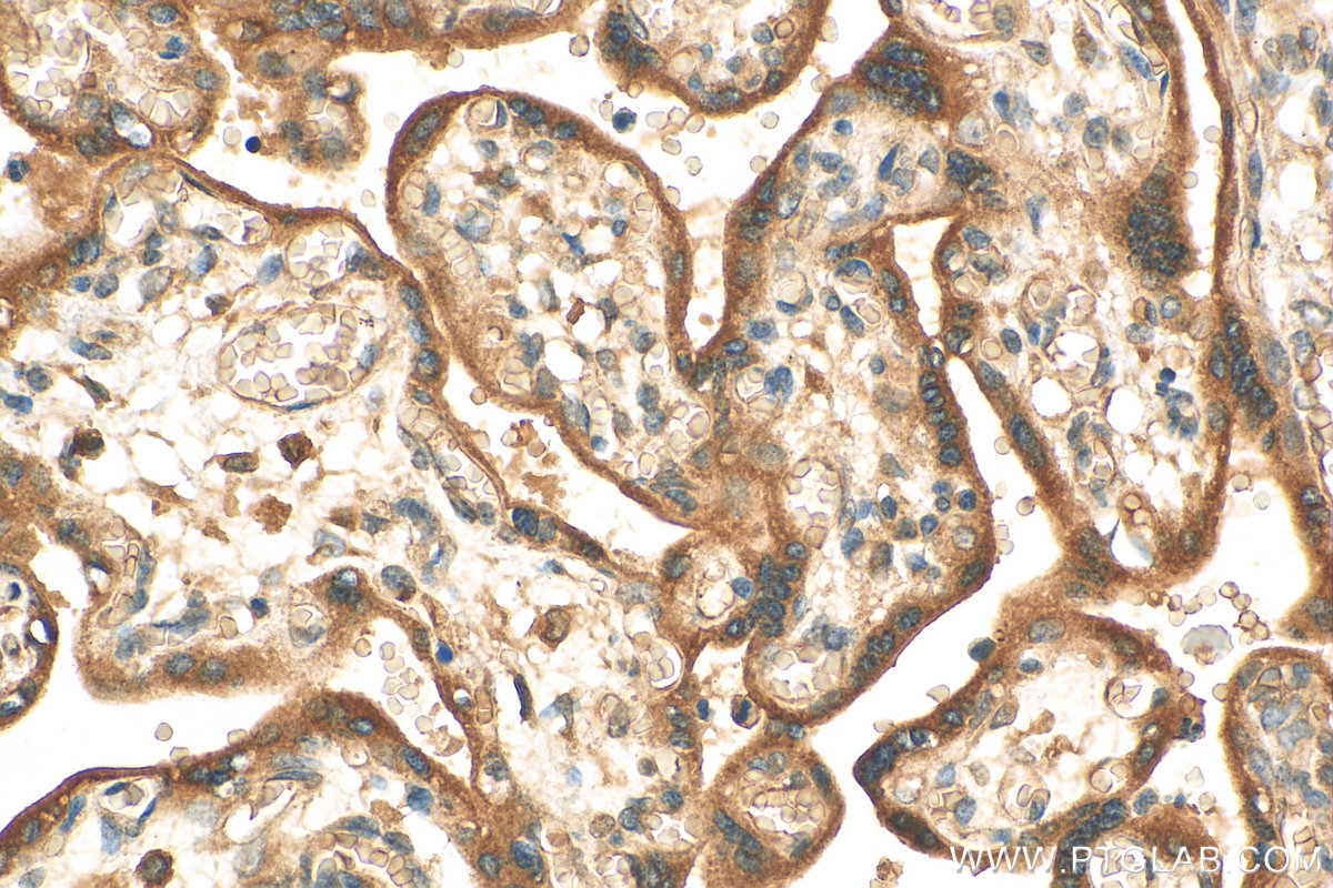 IHC staining of human placenta using 16228-1-AP