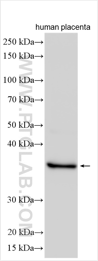 WB analysis of human placenta using 16228-1-AP
