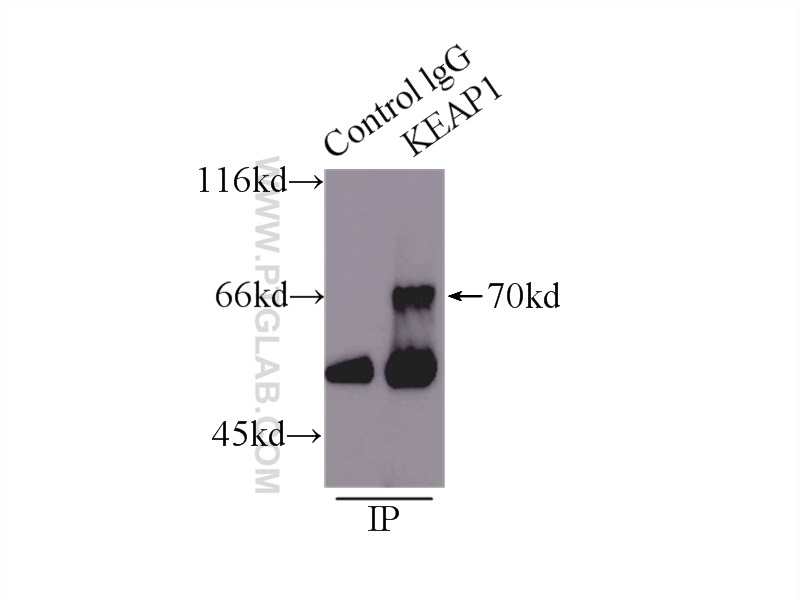 IP experiment of mouse skeletal muscle using 10503-2-AP