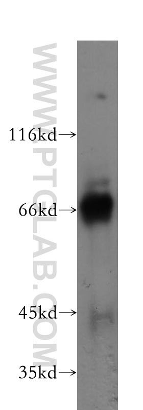 WB analysis of HeLa using 60027-1-Ig