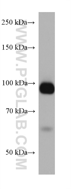 WB analysis of human red blood cells using 67393-1-Ig