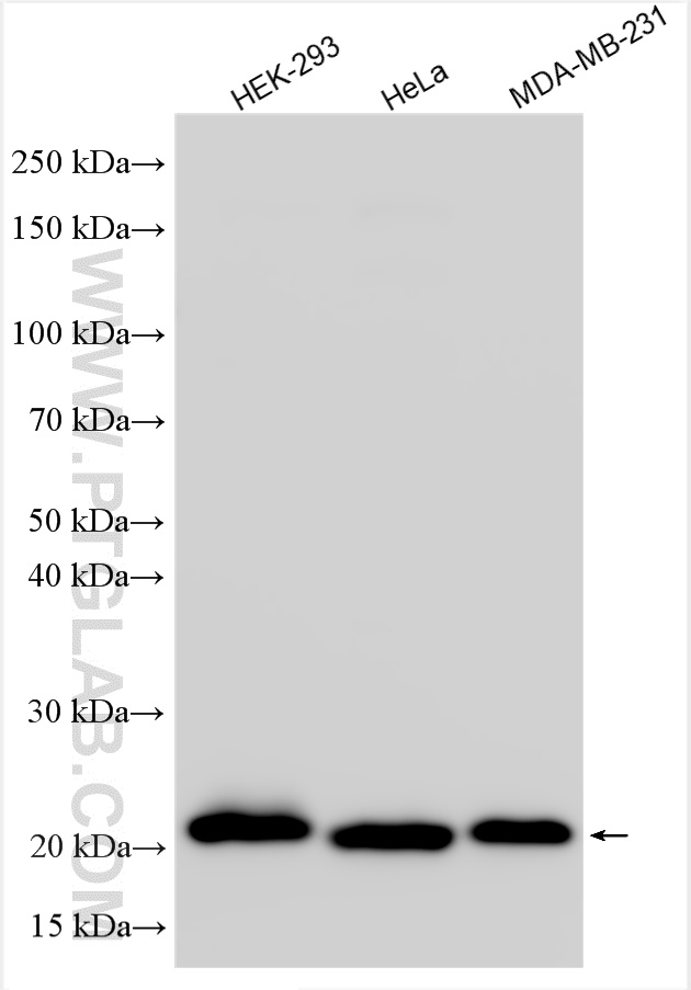 WB analysis using 24933-1-AP (same clone as 24933-1-PBS)