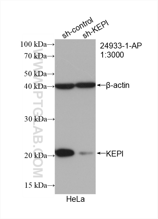 WB analysis of HeLa using 24933-1-AP (same clone as 24933-1-PBS)