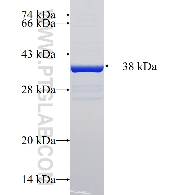 KERA fusion protein Ag34171 SDS-PAGE