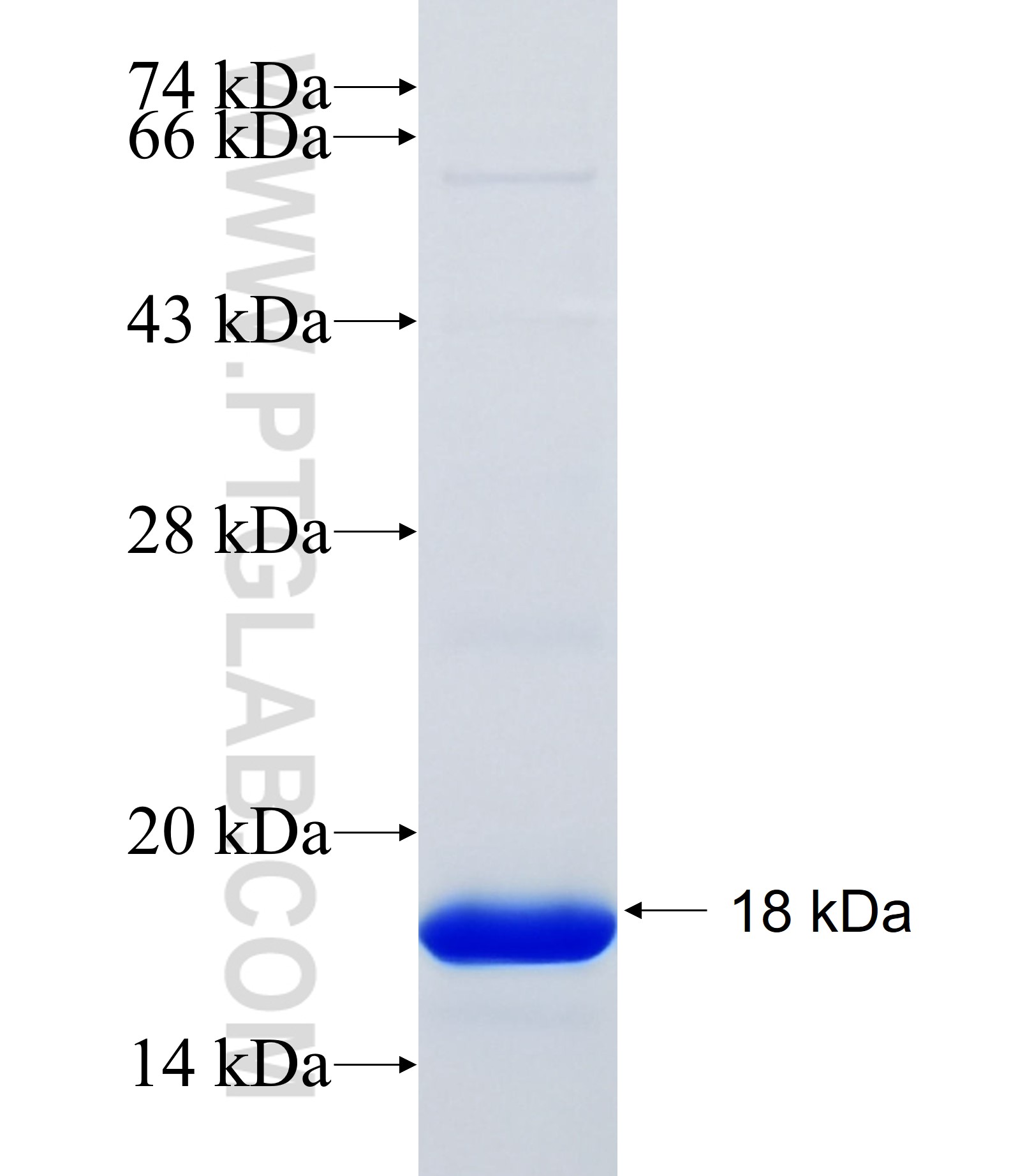 KERA fusion protein Ag34244 SDS-PAGE KERA fusion protein Ag34244 SDS-PAGE