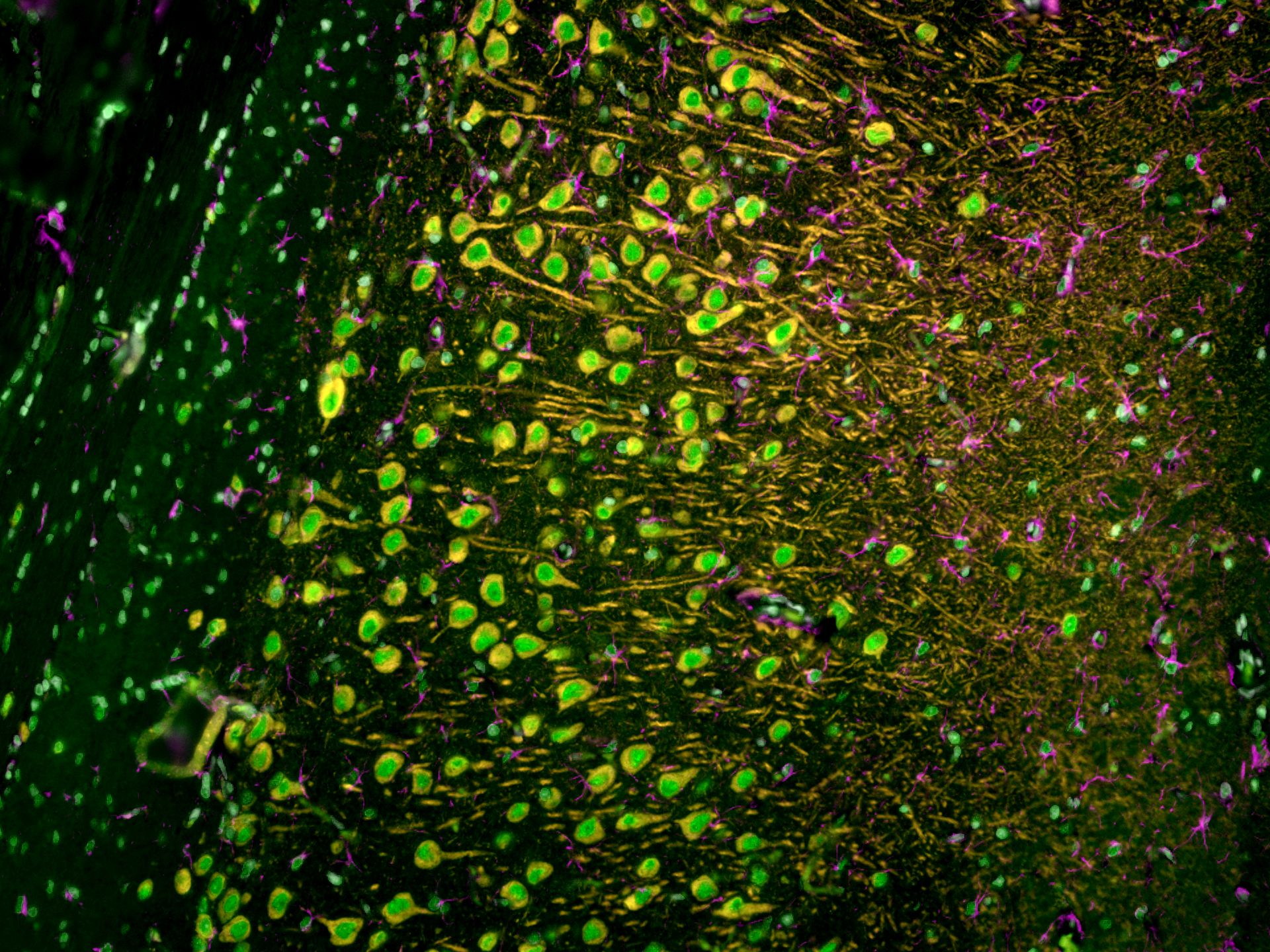 Immunofluorescence of rat brain tissue: FFPE rat brain tissue sections were stained with anti-MAP2 (17490-1-AP) labeled with FlexAble CoraLite® Plus 555 Kit (KFA002, orange), anti-GFAP (16825-1-AP) labeled with FlexAble CoraLite® Plus 647 Kit (KFA003, magenta) and CoraLite®488-conjugated TDP-43 antibody (CL488-10782, green).