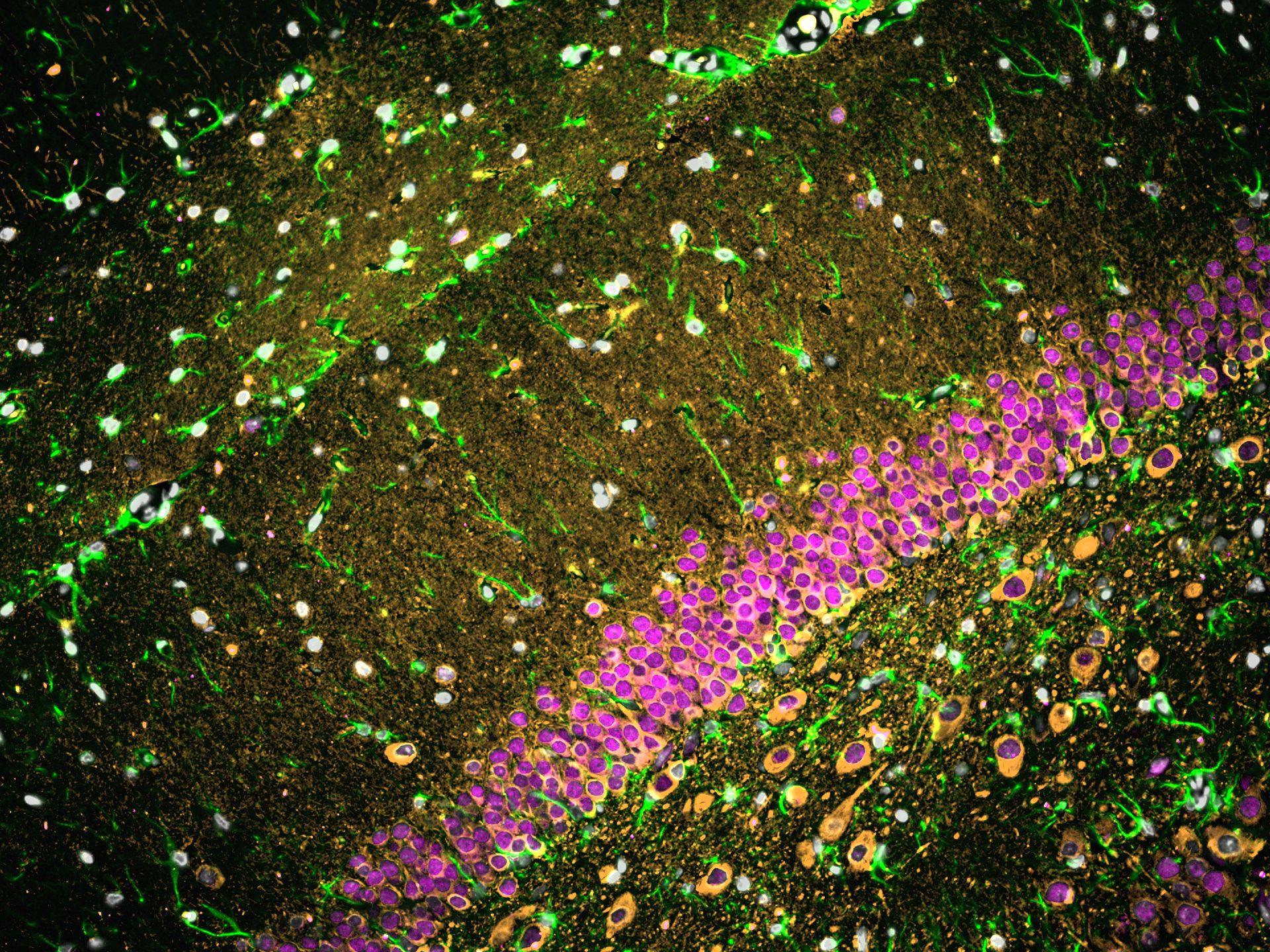 Immunofluorescence of rat brain tissue: FFPE rat brain tissue sections were stained with anti-NeuN (66836-1-Ig) labeled with FlexAble CoraLite® Plus 647 Kit (KFA023, magenta), anti-TUBB3 (66375-1-Ig) labeled with FlexAble CoraLite® Plus 555 Kit (KFA022, orange), and CoraLite®488-conjugated GFAP antibody (CL488-60190, green).