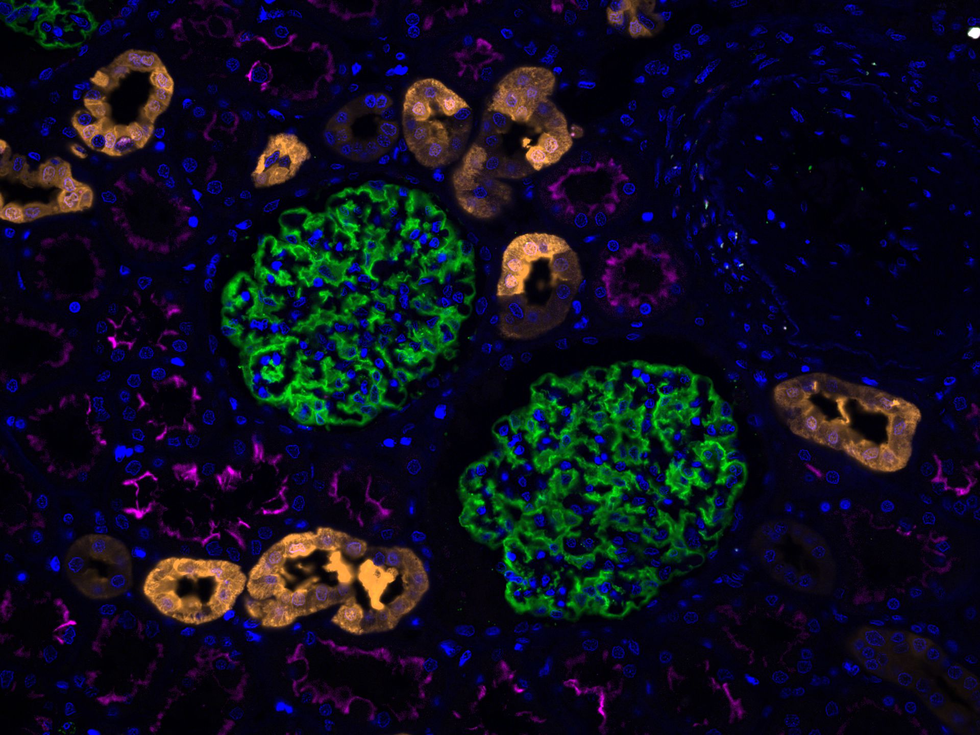 Immunofluorescence of human kidney: FFPE human kidney sections were stained with anti-Calbindin (14479-1-AP) labeled with FlexAble CoraLite® Plus 555 Kit (KFA002, yellow), anti-ACE2 (66699-1-Ig) labeled with FlexAble CoraLite® Plus 647 Kit (KFA023, magenta), CoraLite®488-conjugated Podocalyxin antibody (CL488-18150, green) and DAPI (blue).