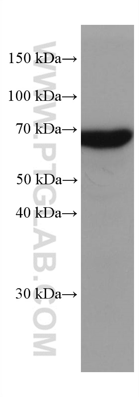 WB analysis of mouse brain using 66265-2-Ig (same clone as 66265-2-PBS)