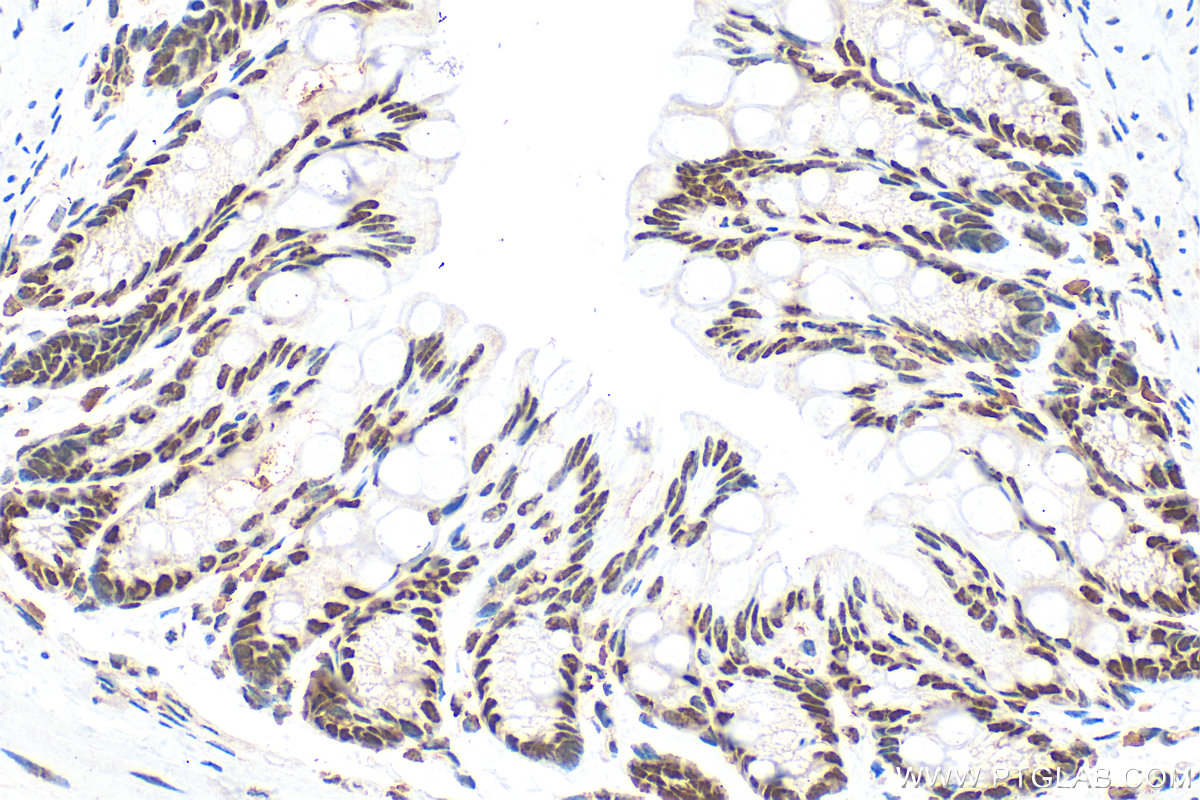 IHC staining of mouse colon using 10222-1-AP