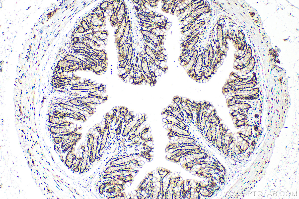 IHC staining of mouse colon using 10222-1-AP