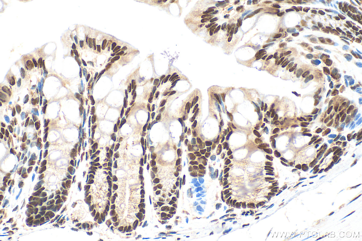 IHC staining of mouse colon using 10222-1-AP