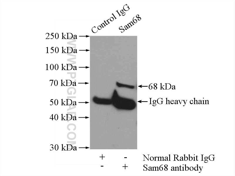 IP experiment of HeLa using 10222-1-AP