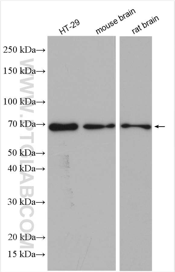 WB analysis using 10222-1-AP