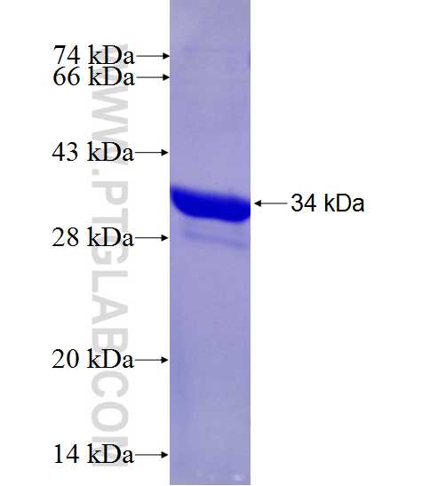 KHDRBS2 fusion protein Ag27623 SDS-PAGE KHDRBS2 fusion protein Ag27623 SDS-PAGE