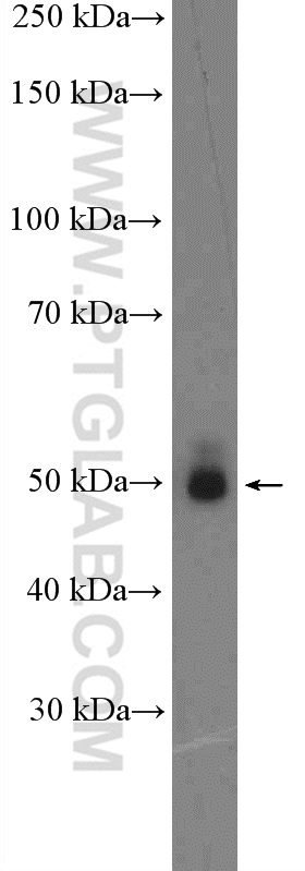 WB analysis of mouse brain using 13563-1-AP