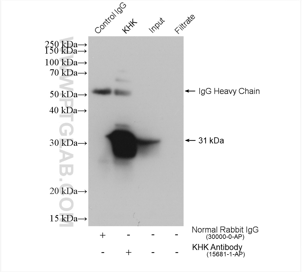 IP experiment of HepG2 using 15681-1-AP