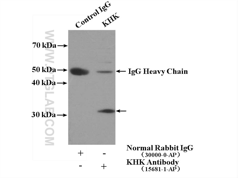 IP experiment of mouse liver using 15681-1-AP