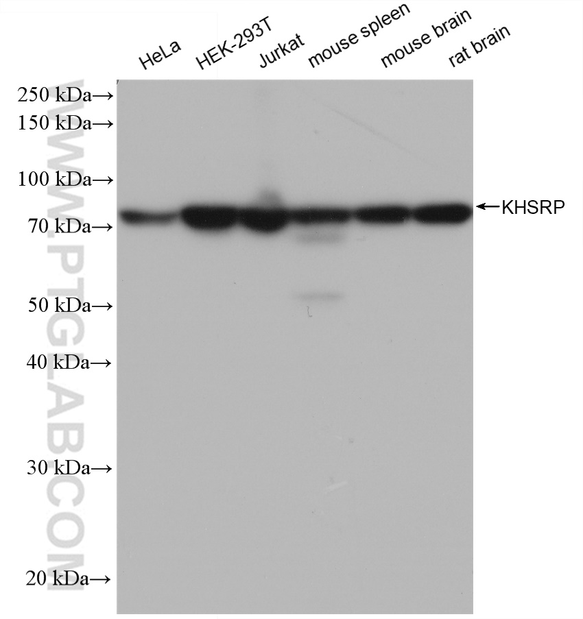 WB analysis using 82931-1-RR