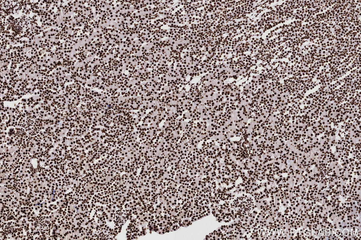 IHC staining of mouse kidney using 82931-5-RR IHC staining of mouse kidney using 82931-5-RR