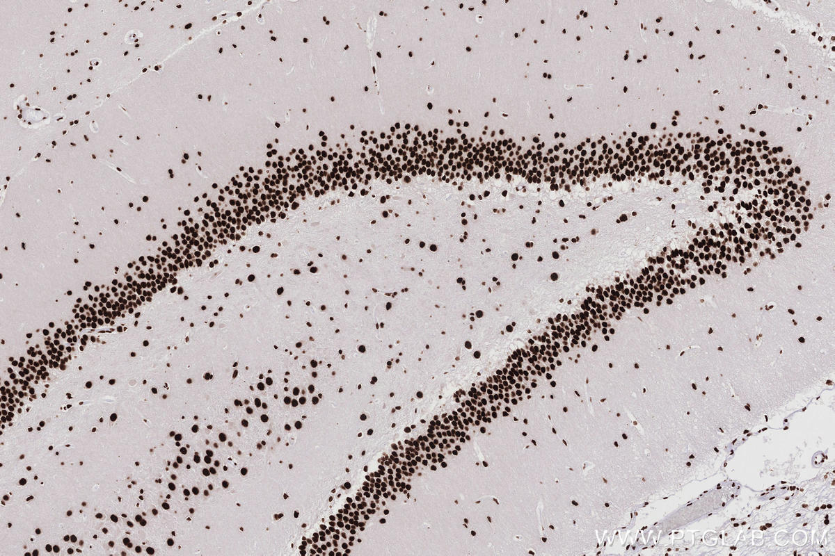 IHC staining of rat brain using 82931-5-RR IHC staining of rat brain using 82931-5-RR