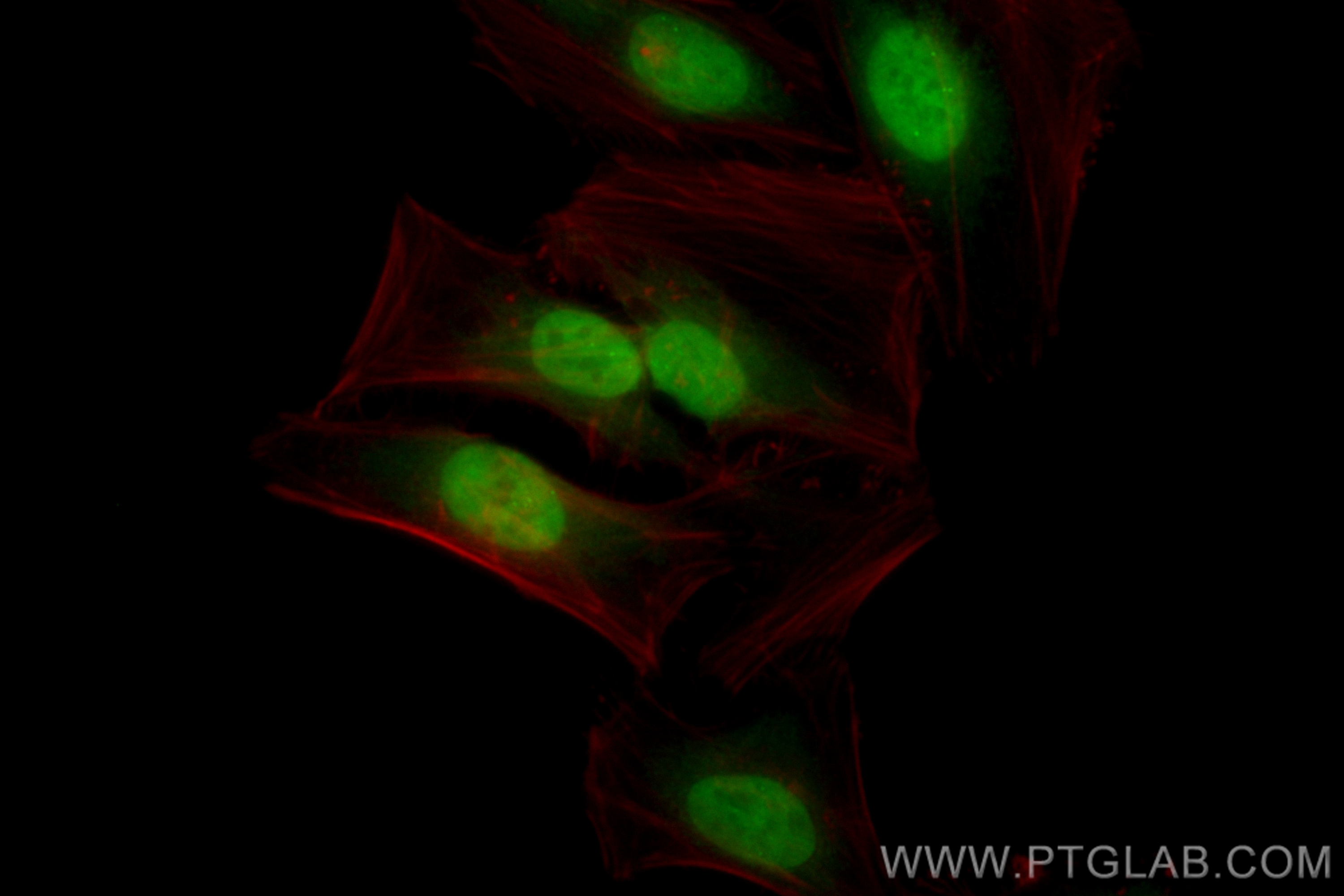 IF Staining of HeLa using CL488-82931-5