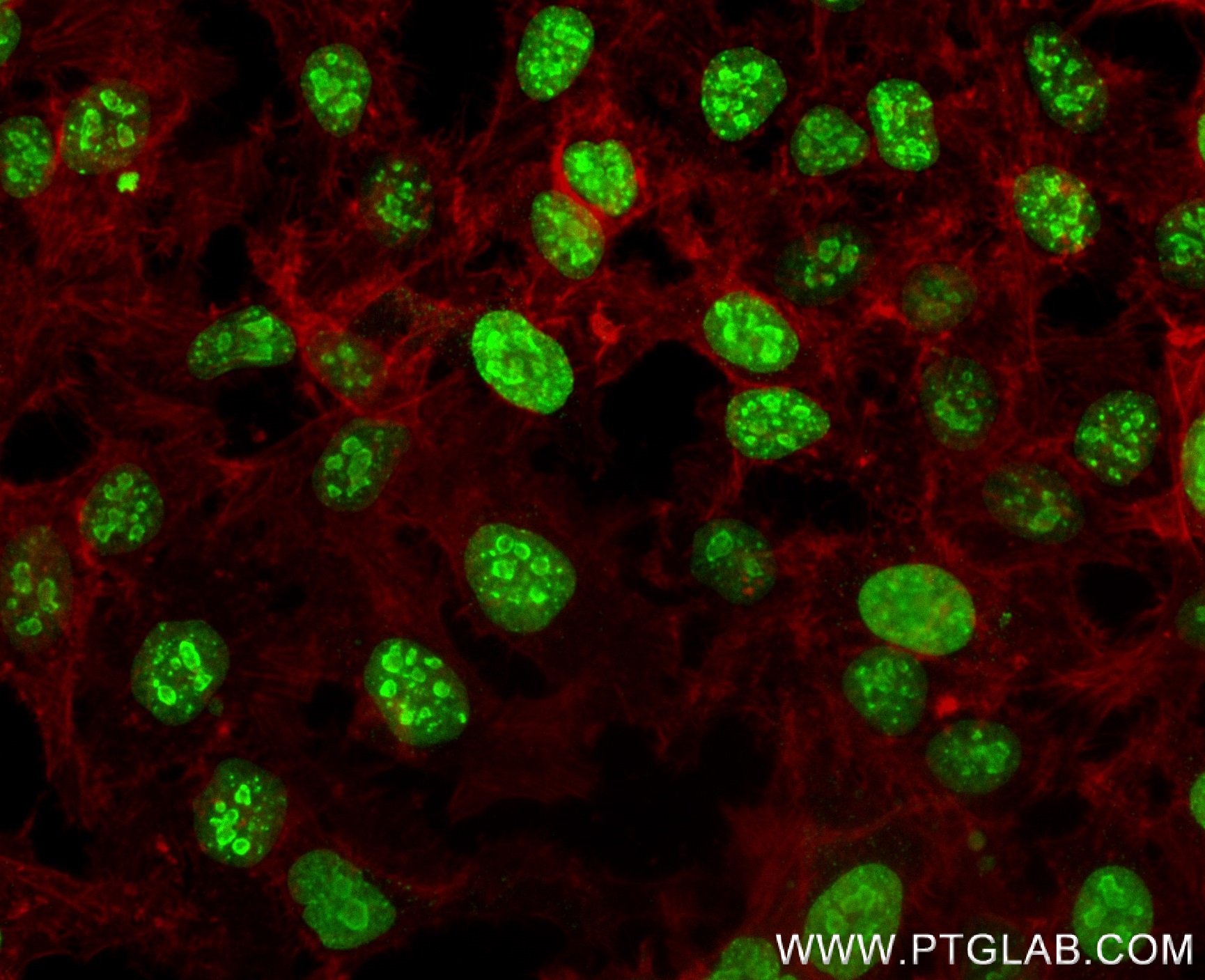 IF Staining of HeLa using 84192-3-RR IF Staining of HeLa using 84192-3-RR