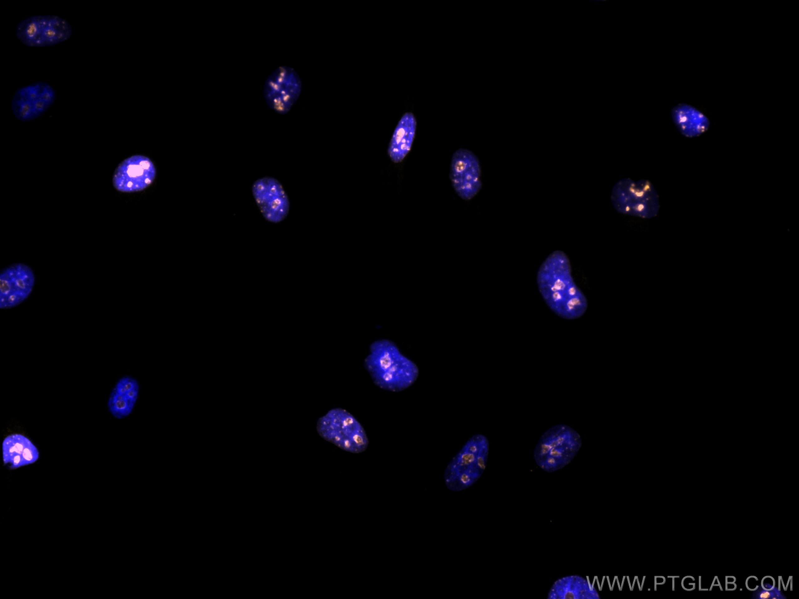 IF Staining of HeLa using CL555-27309