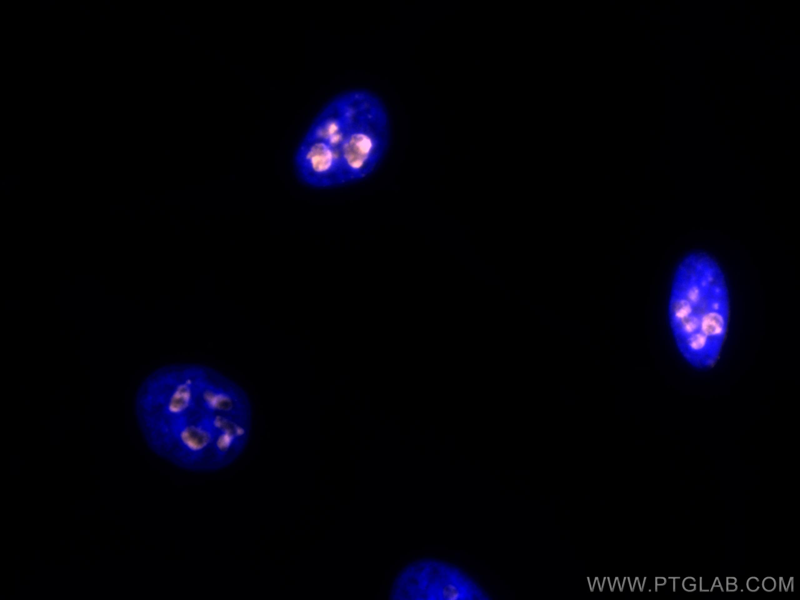 IF Staining of HeLa using CL555-27309