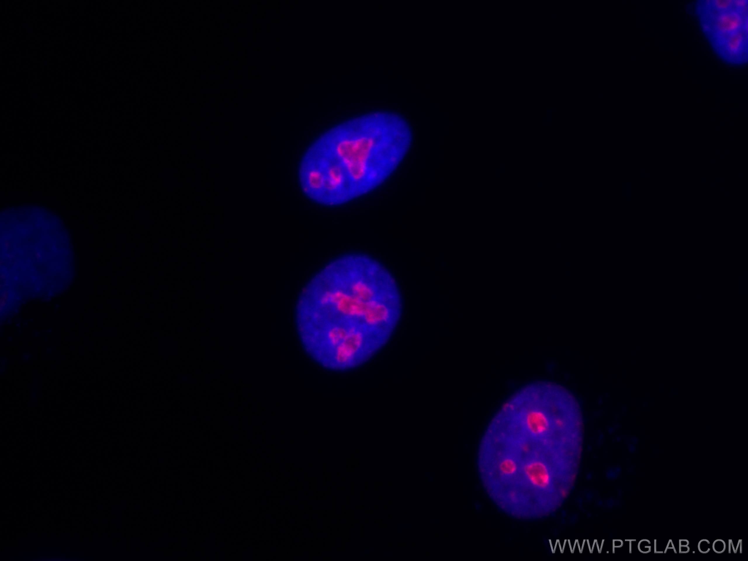 IF Staining of HeLa using CL594-27309