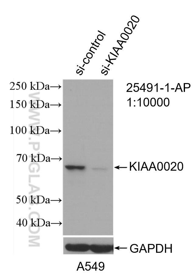 WB analysis of A549 using 25491-1-AP