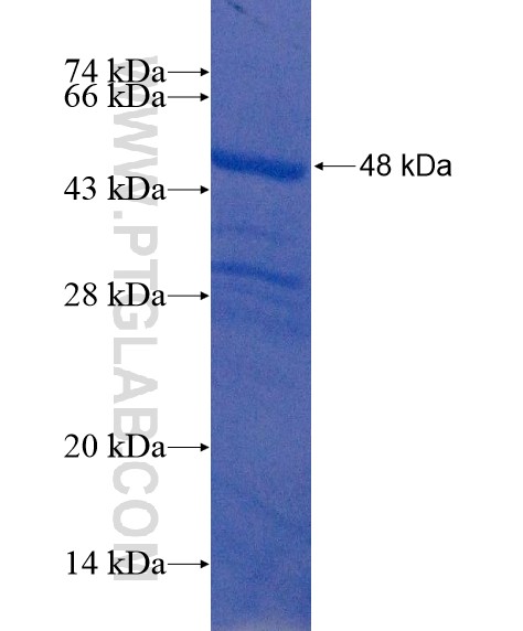 KIAA0020 fusion protein Ag22011 SDS-PAGE