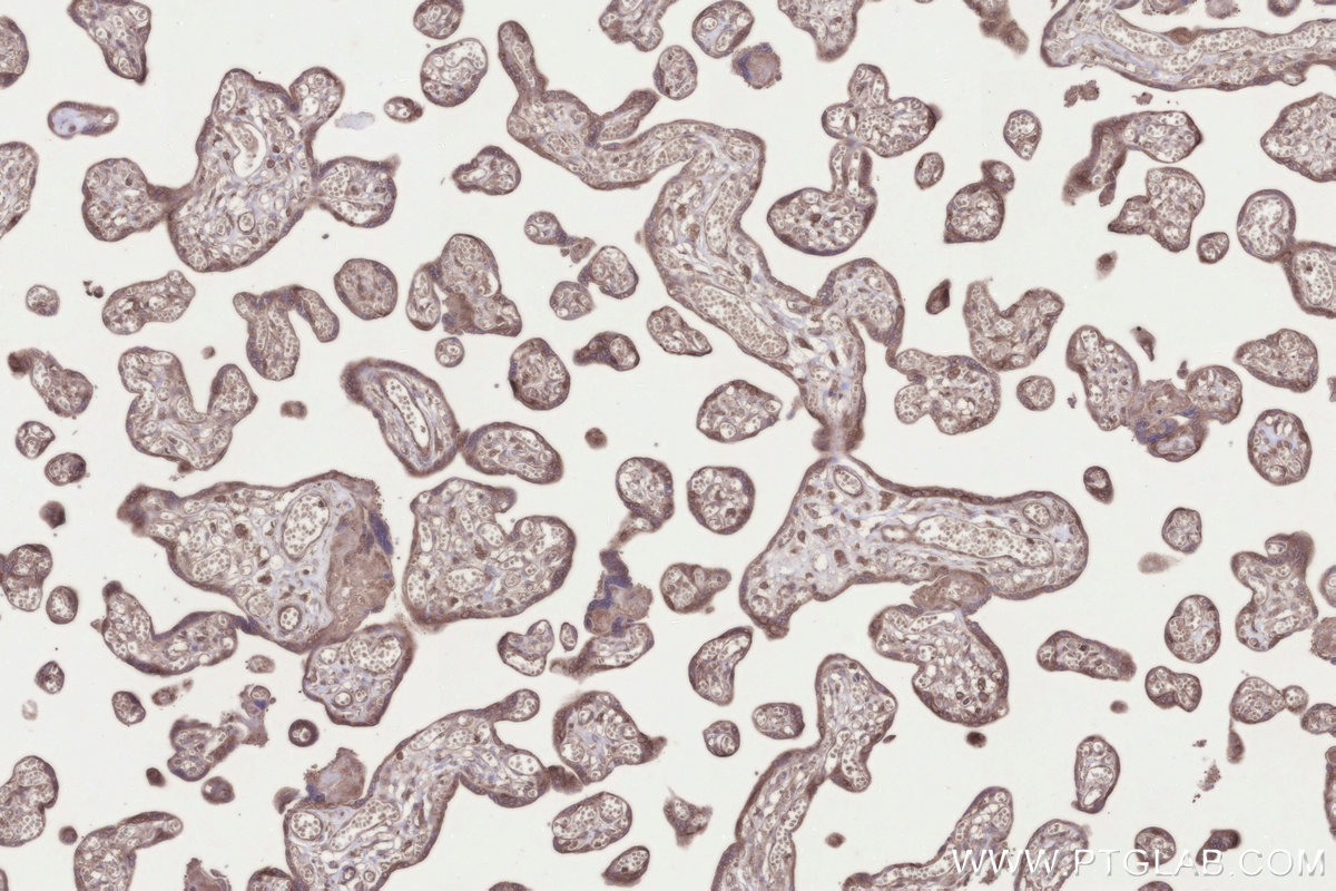 IHC staining of human placenta using 26017-1-AP