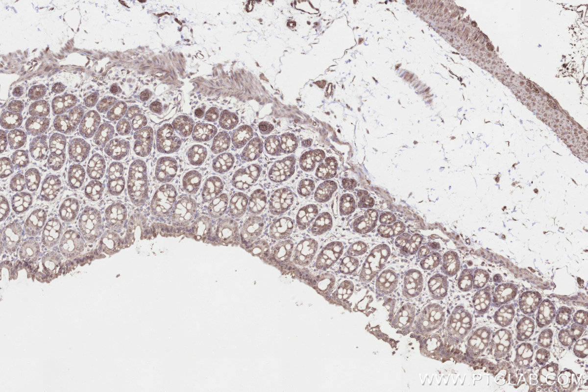 IHC staining of rat colon using 26017-1-AP