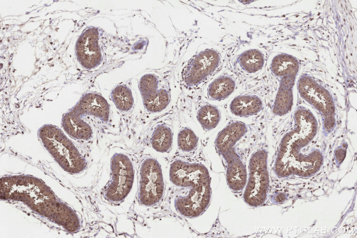IHC staining of rat epididymis using 26017-1-AP